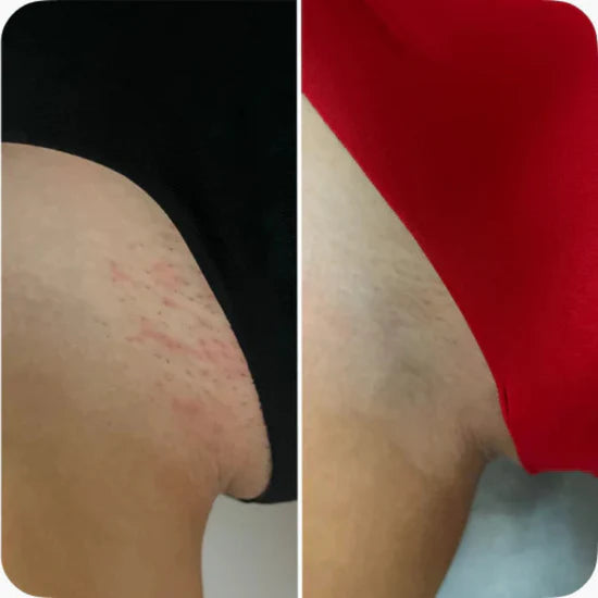 Antes / Después