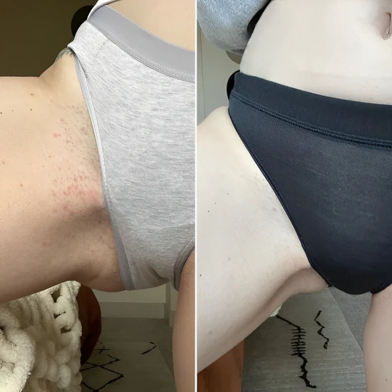 Antes / Después